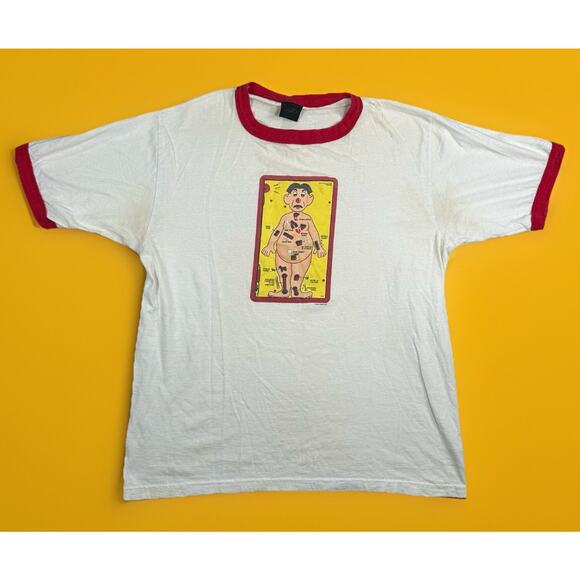 VTG MB Operation Ringer Shirt Changes Tag Board Game Y2K Men’s Size XL 2001 - Picture 1 of 12